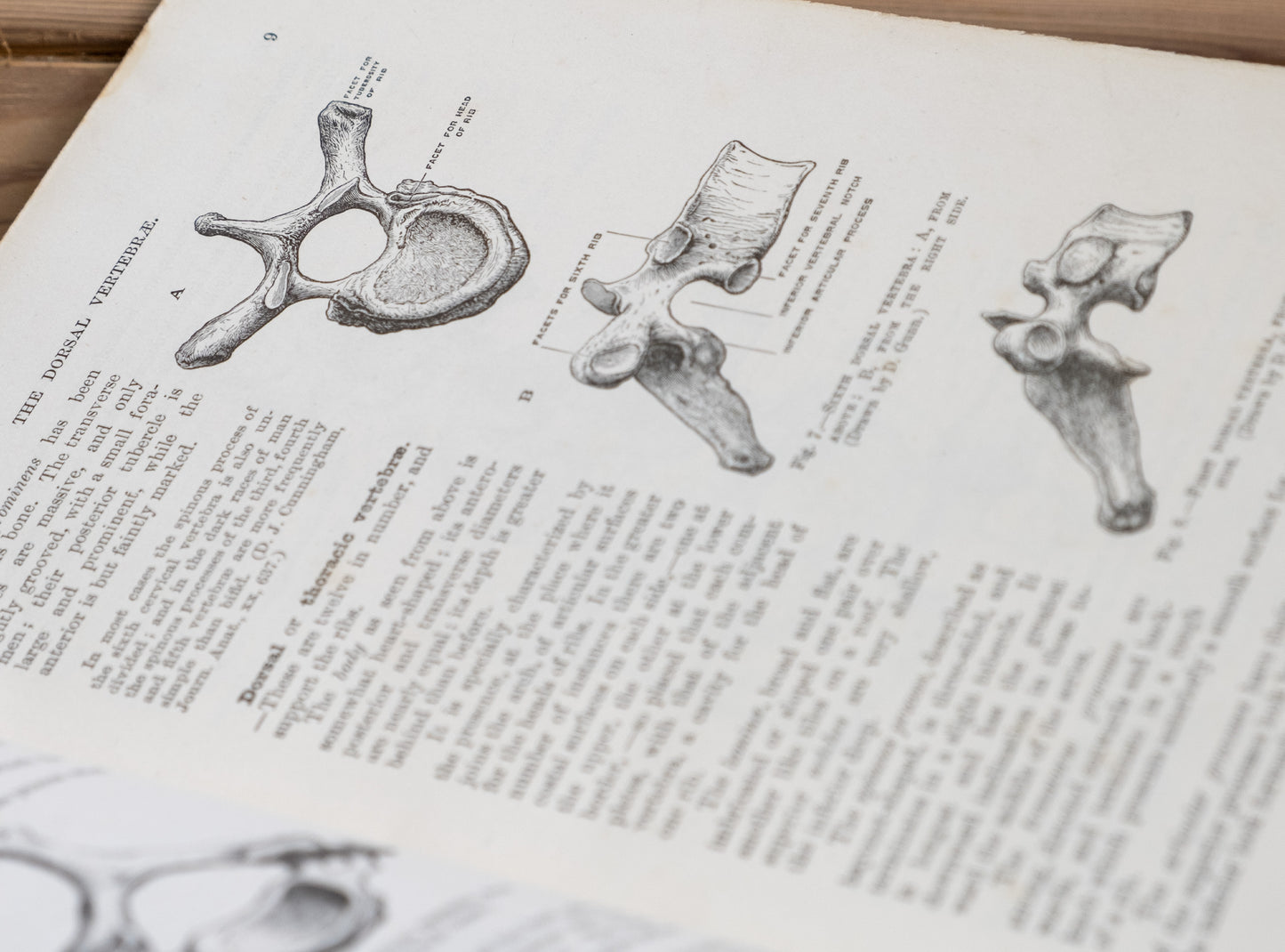 Quain's Anatomy Vol II Osteology