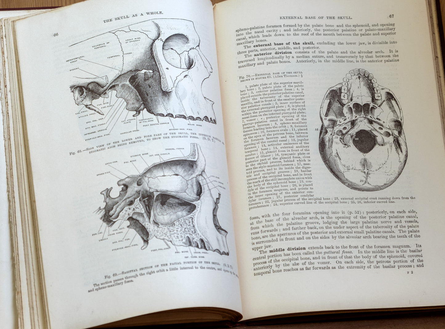 Quain's Anatomy Vol II Osteology