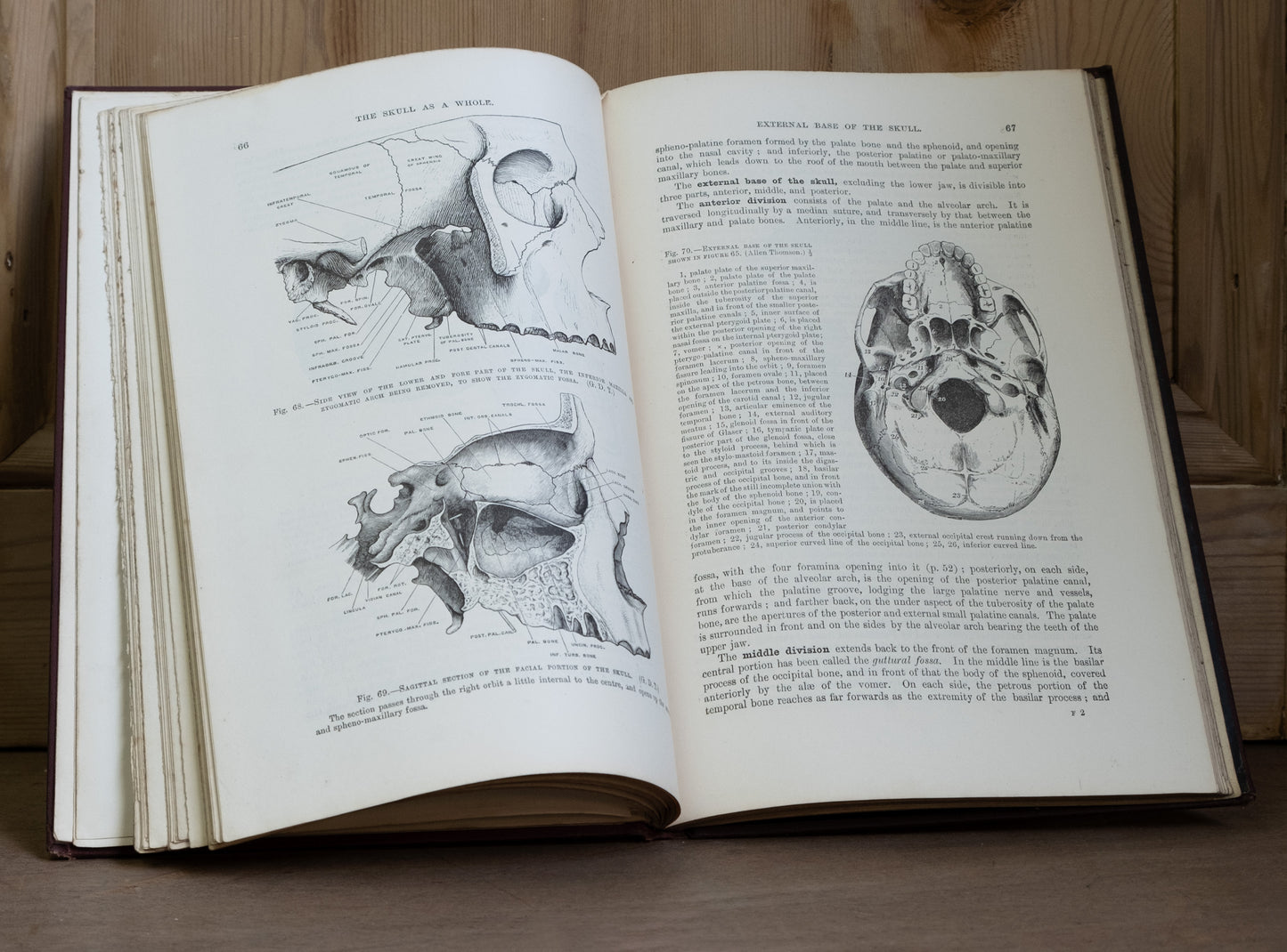 Quain's Anatomy Vol II Osteology